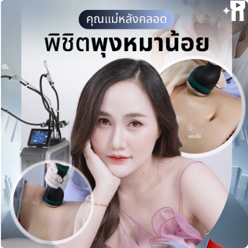 พิชิตพุงหมาน้อย